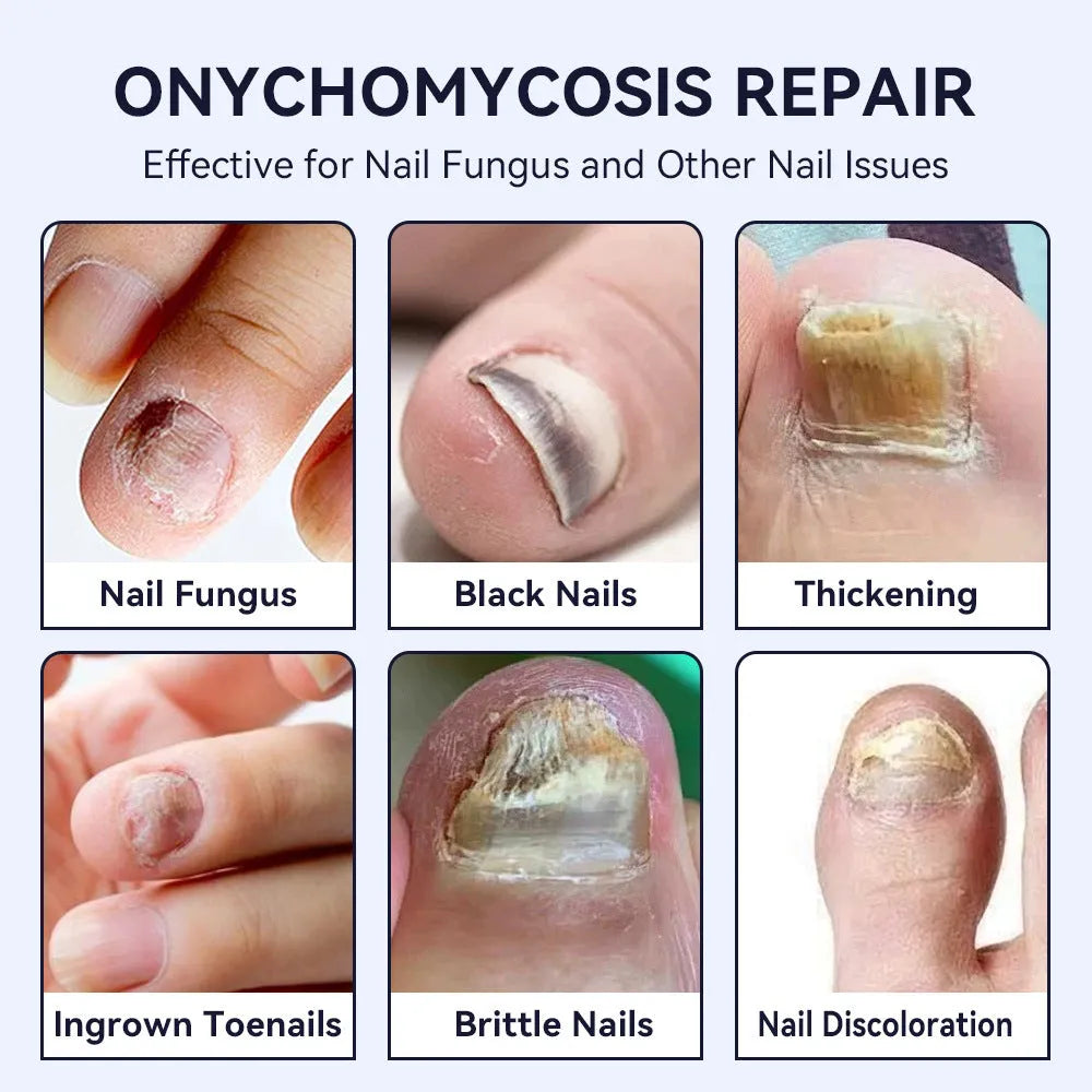Hand and foot nail thickening brightening antibacterial care solution 3ml bottle