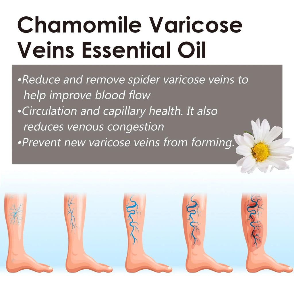 10ml chamomile essential oil bottle for leg care and massage