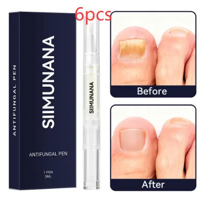 Hand and foot nail thickening brightening antibacterial care solution 3ml bottle