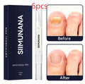 Hand and foot nail thickening brightening antibacterial care solution 3ml bottle