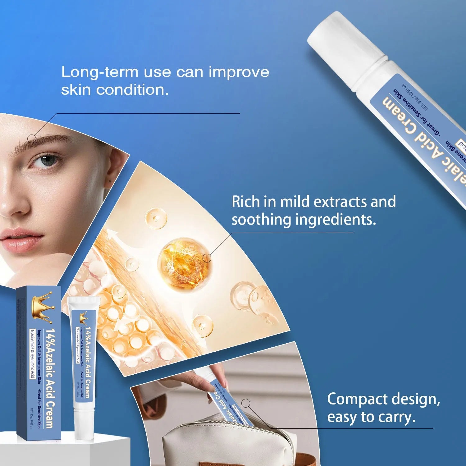 Azelaic acid cream 30g tube in blue packaging with FPA035 label for general skin care treatment.
