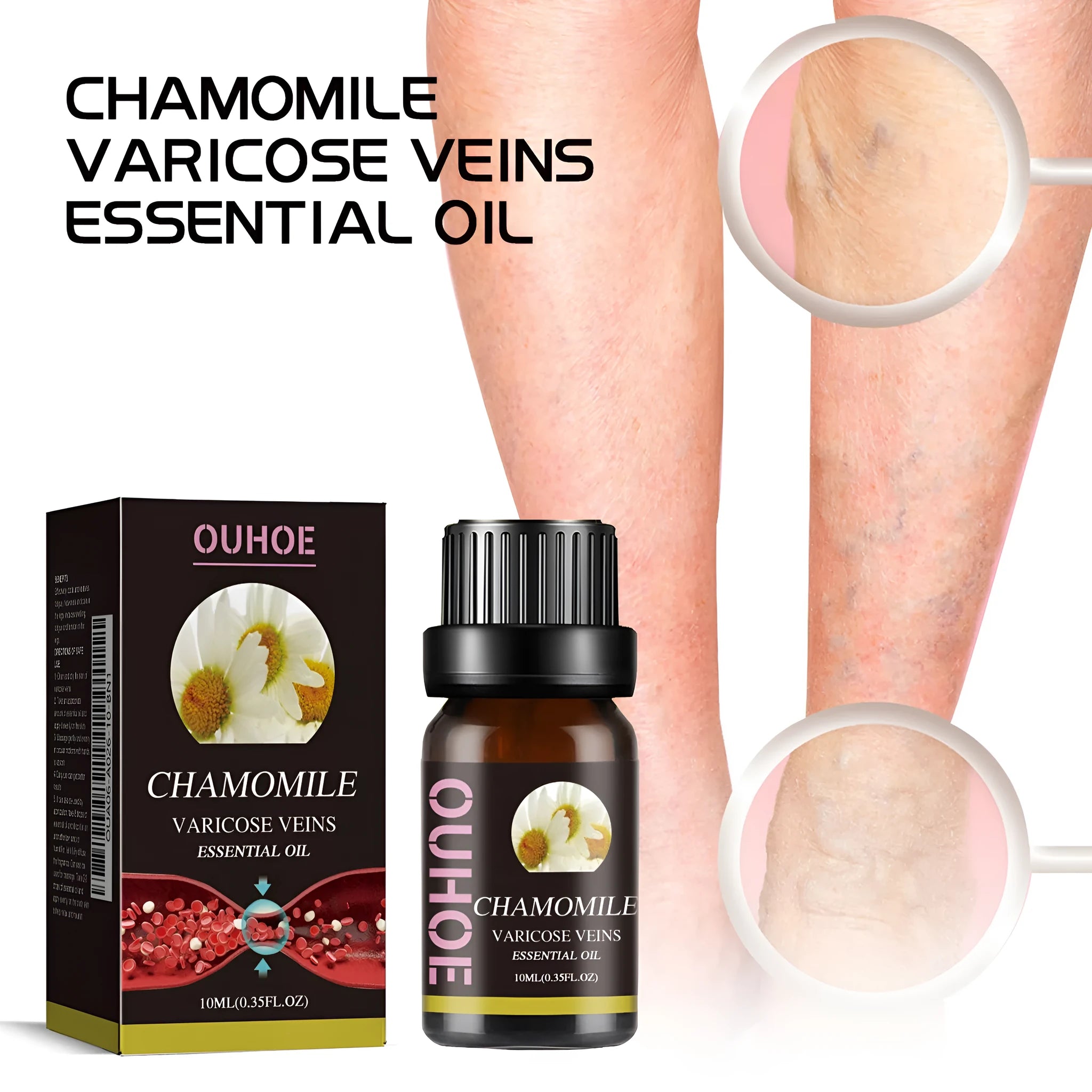 10ml chamomile essential oil bottle for leg care and massage