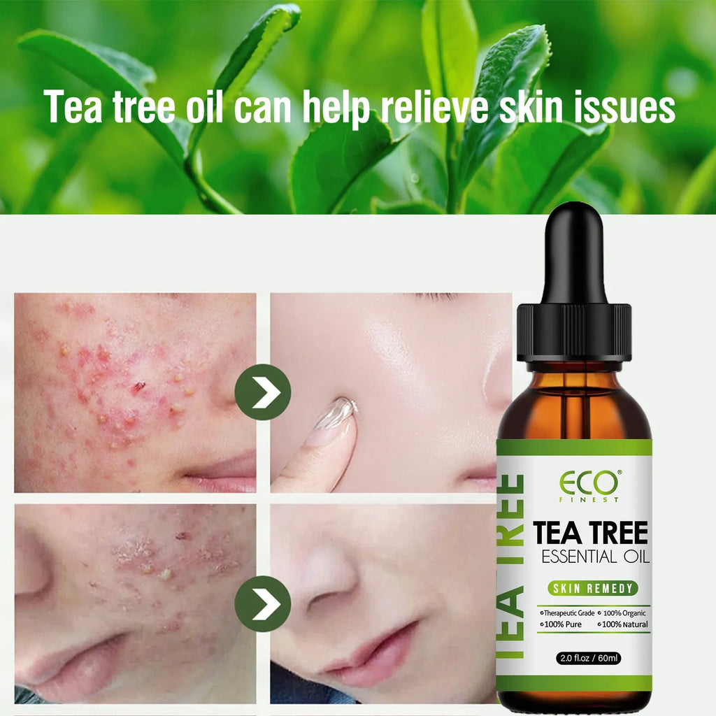 60ml bottle of pure tea tree essential oil for acne treatment and skin blemish reduction