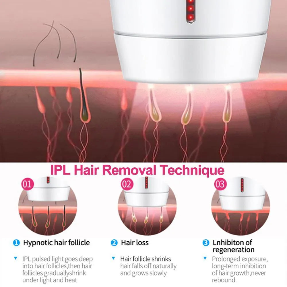 White home laser hair removal device with display, shown with its power adapter and international plug heads.