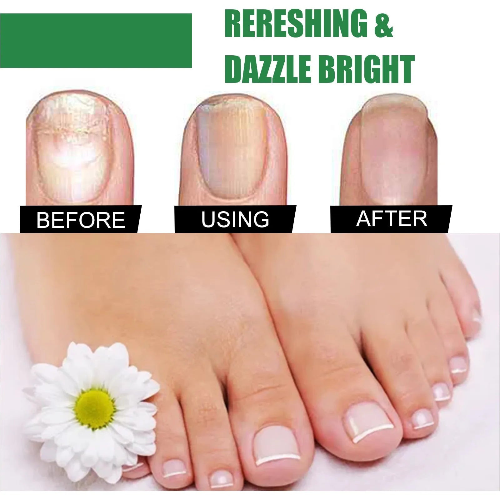 30ml tea tree oil nail repair treatment bottle for thickened toenails and fingernails