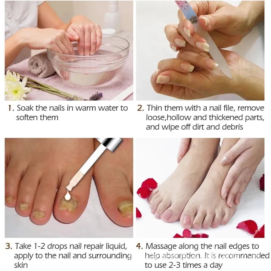 Jiagou 10ml Whitenail Antibacterial Liquid bottle for foot care treatment