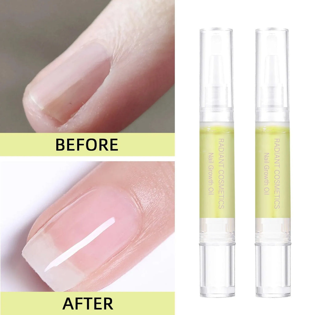 3ml bottle of nail growth and moisturising treatment oil for cuticle care