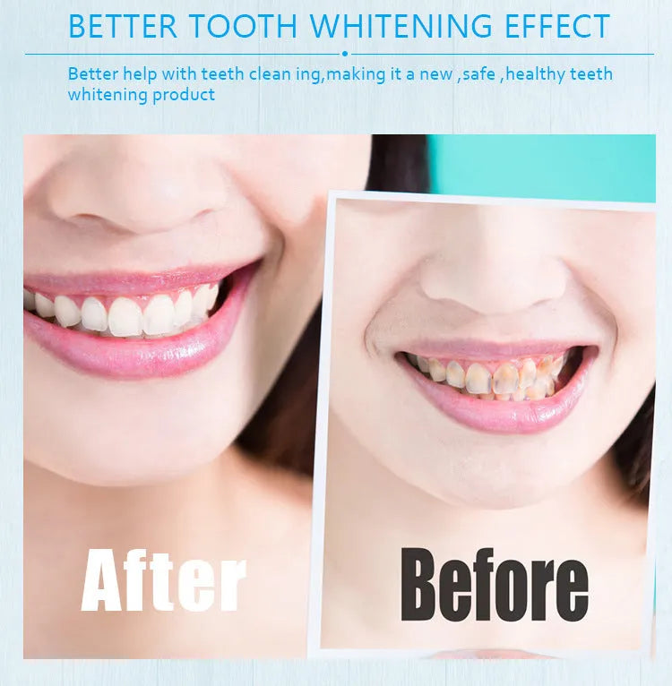 Gold aluminium teeth whitening pen with plastic brush applicator tip and 2ml gel capacity