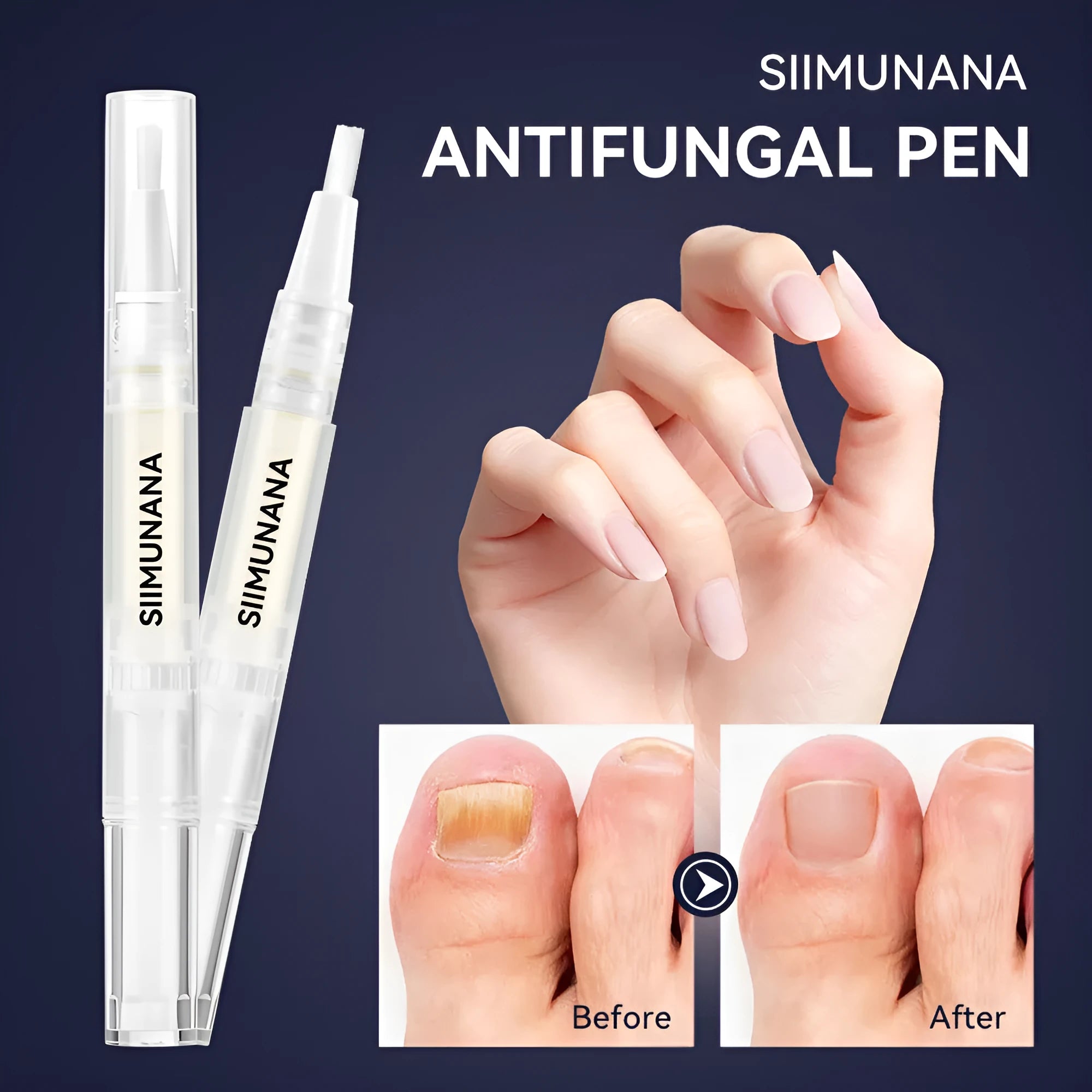 Hand and foot nail thickening brightening antibacterial care solution 3ml bottle