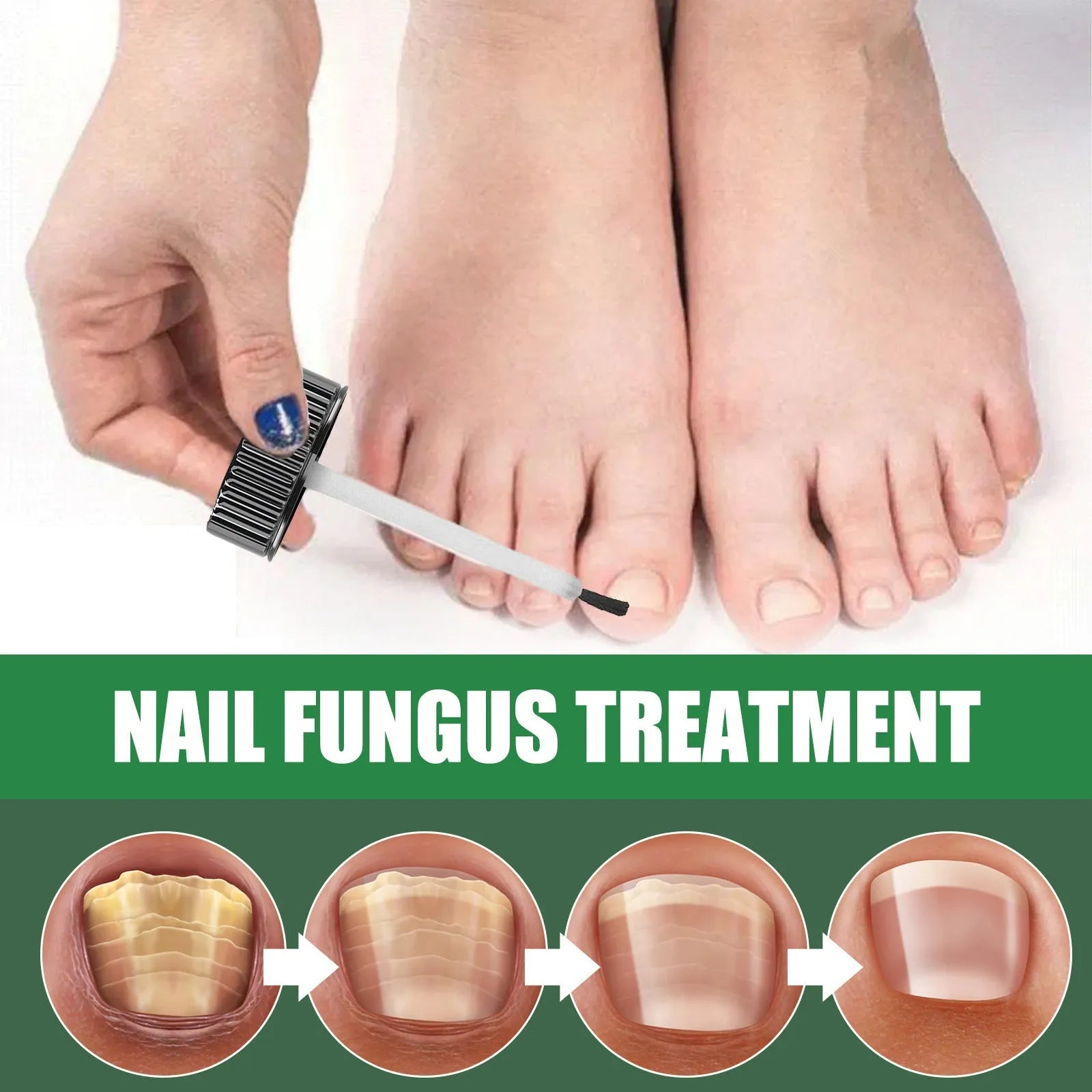 30ml tea tree oil nail repair treatment bottle for thickened toenails and fingernails