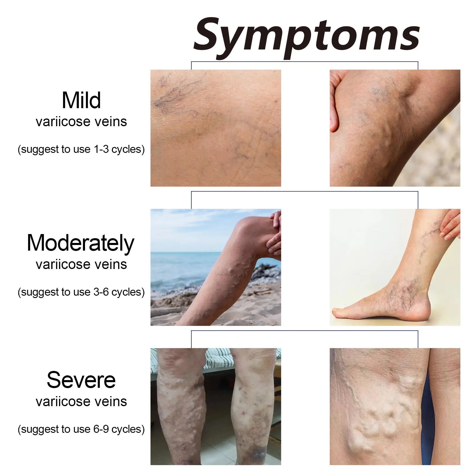 10ml chamomile essential oil bottle for leg care and massage