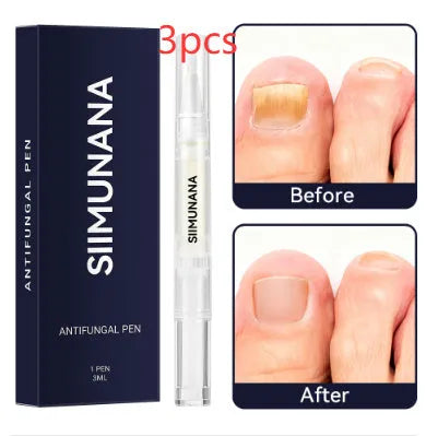 Hand and foot nail thickening brightening antibacterial care solution 3ml bottle
