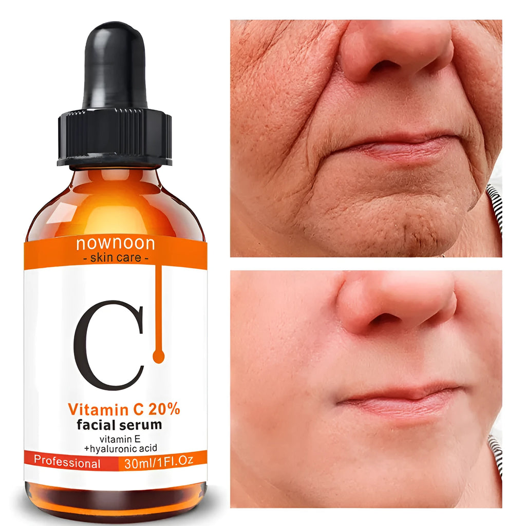 Vitamin C Facial Serum 30ml bottle with snow lotus extract for hydration