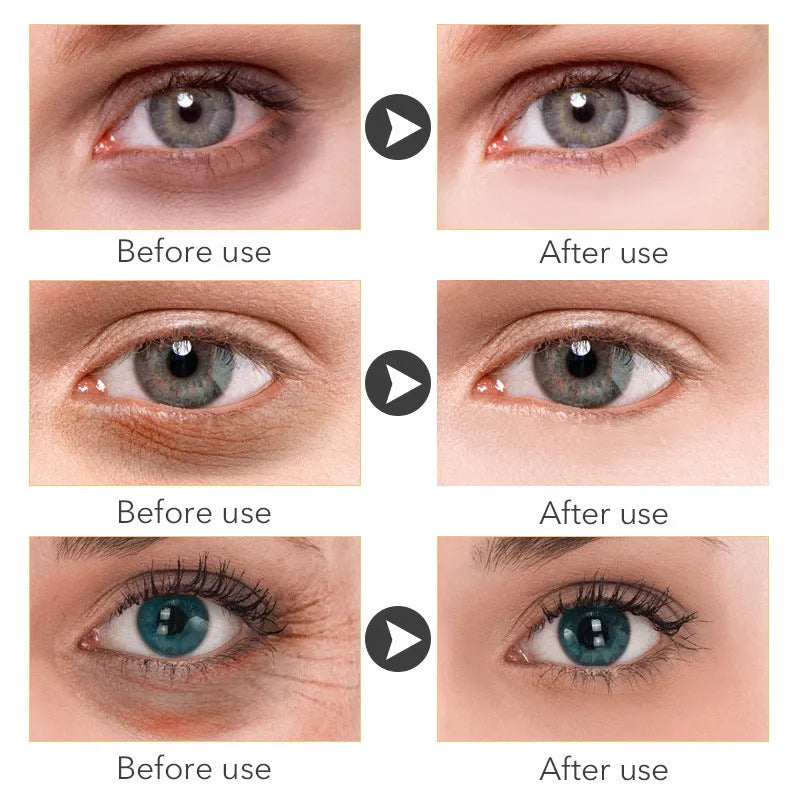 30ml women's eye cream bottle for targeted skin treatment around eyes