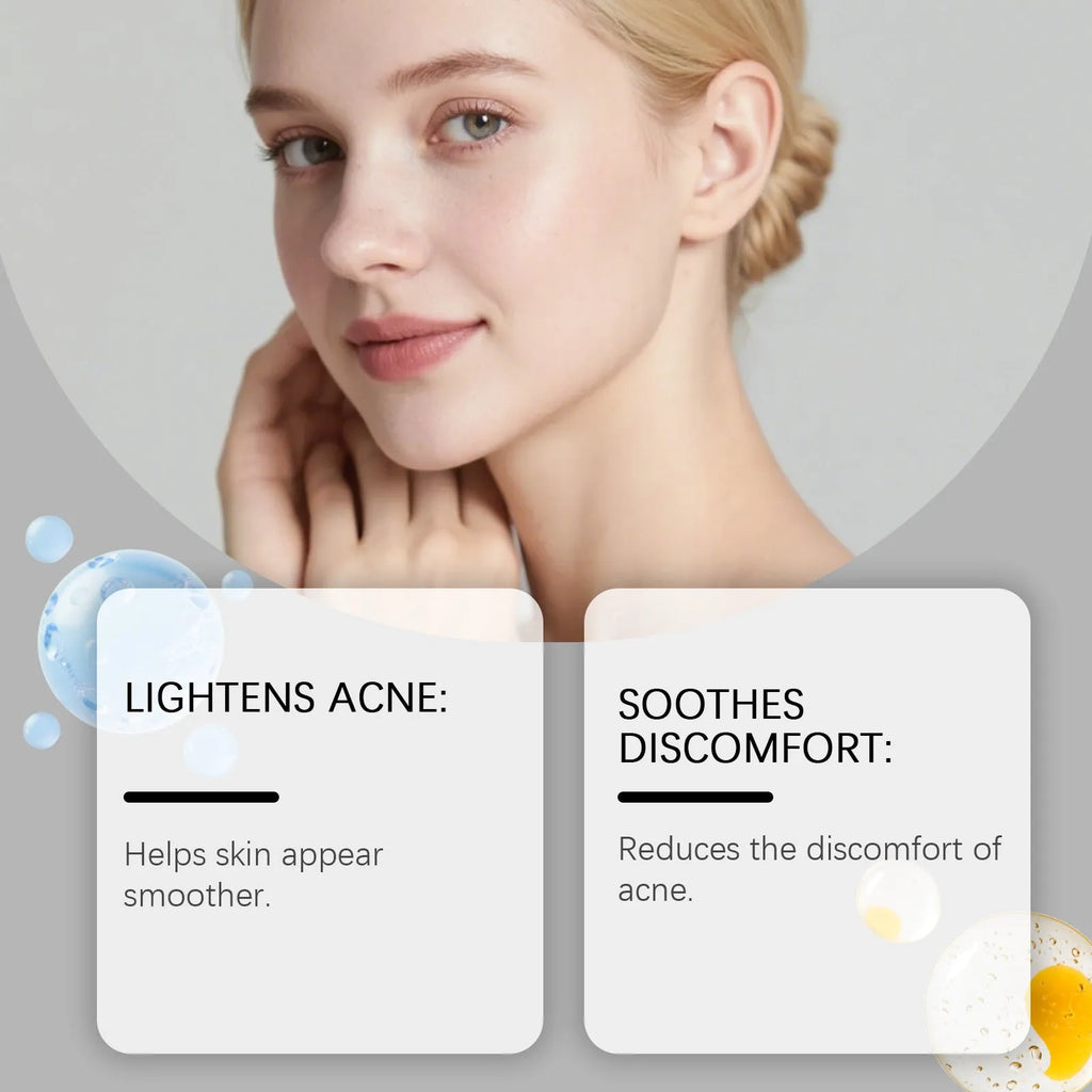 Pack of 80 hydrocolloid facial acne patches for pimple treatment.