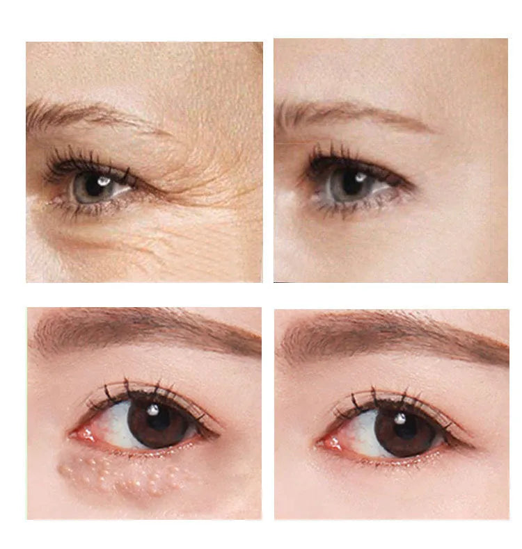 30ml women's eye cream bottle for targeted skin treatment around eyes