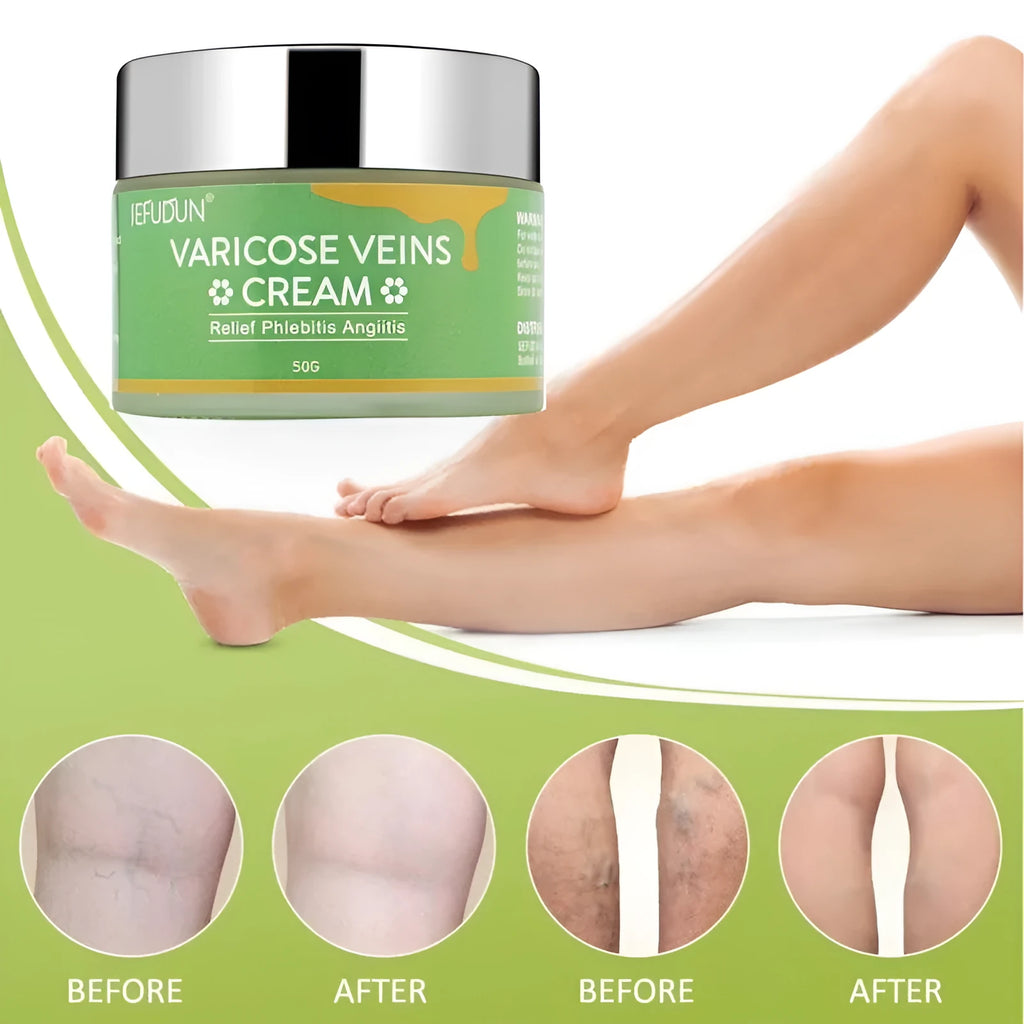 50g pot of vein cream with natural ingredients for varicose vein relief